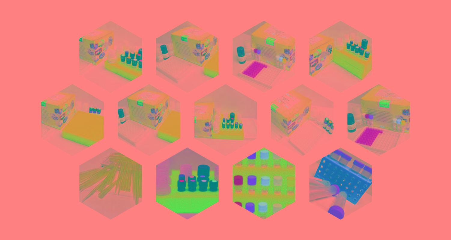 試劑盒|產(chǎn)品檢測試劑盒|代理品牌