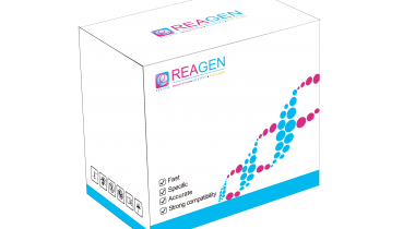 對(duì)蝦桿狀病毒（BP）DNA恒溫核酸檢測(cè)試劑盒（不含提?。? />
                            </a>
                        </div>
                                            </div>
                </div>
                <div   id="y8aegyc"   class="col-lg-5">
                    <div   id="emaeq22"   class="product-intro">
                        <h1 class=